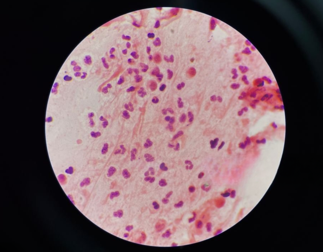 Uma imagem de uma lâmina para hemocultura
